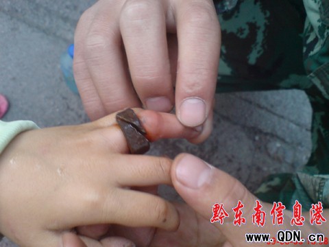 �к���ָ����ҧ��  ���ڳɹ����Ρ������D��