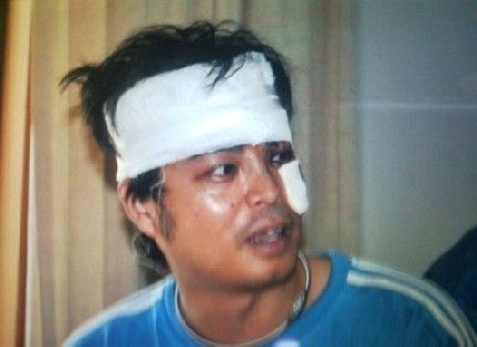 �M�D���껨�����������ع� �F��Ѫ�E�߰�