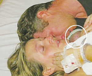 早產兒被宣告死亡母親撫摸2小時后將孩子救活