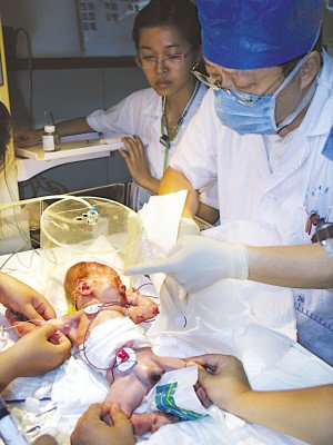 Ů��������a(ch��n)�Ӻ󌢋냺��������(�D)