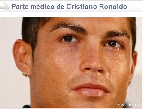皇馬官方宣布頭牌傷情 舊患復發C羅傷停三周