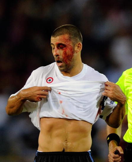 組圖:巖石血染賽場 獵豹無奈平局眼神已空洞