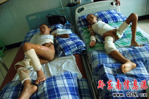 廢棄水泵房上“躲貓貓” 兩孩童痛失手臂(圖)