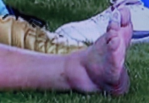 �M�D��÷���w�S������¡ Ƥ�˱��l����һȭ