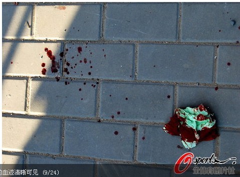 �M�D���|�����������[Ⱥ�� ���^�B�rѪֱ��