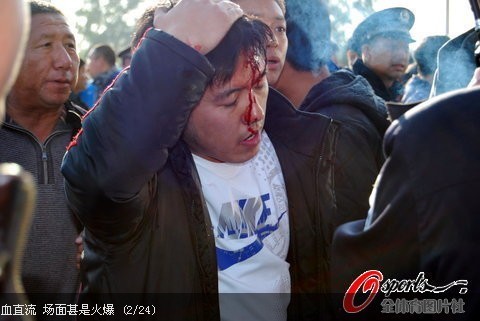 �M�D���|�����������[Ⱥ�� ���^�B�rѪֱ��