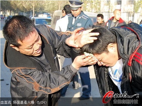 �M�D���|�����������[Ⱥ�� ���^�B�rѪֱ��