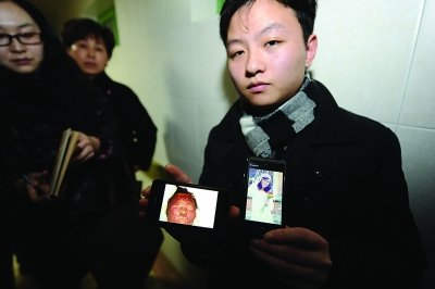 女孩火海救人被毀容續(xù):十指可能全被截(圖)