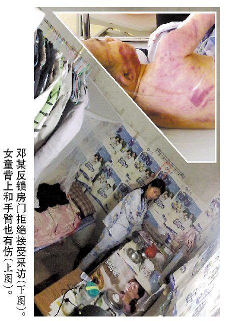 后媽虐打3歲女童 將其打致腦出血扔在便池內(nèi)