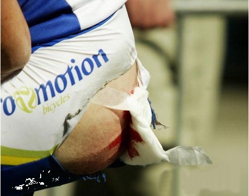 組圖:自行車賽場慘烈瞬間