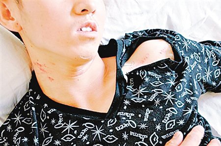 法院司機酒后駕警車肇事打人 法院稱系臨時工