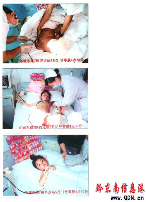 天使容顏車禍瞬間失色—雛鷹剛展翅,噩夢把翼折