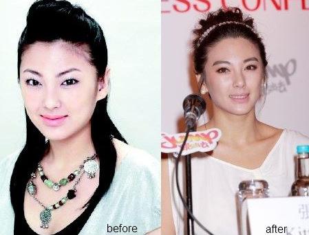 張雨綺整容前后差別大 整得像宋慧喬?