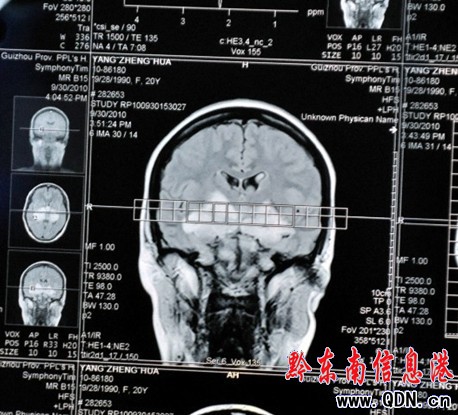 �pĿʧ��Ů�� �� ���ҕ���գ��D��