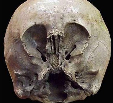 ī����֮��^�ǣ��ɞ������˺͵����˻�Ѫ��