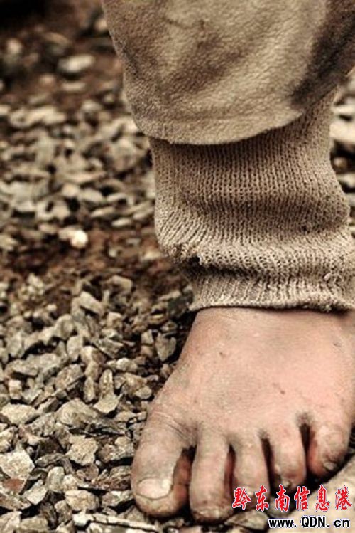 ������޶�壺��(z��i)������Ь�����^�����D��