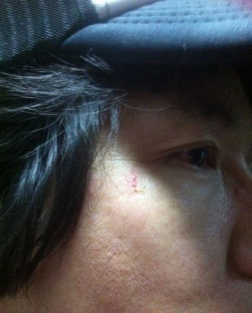 水木年華商演起糾紛被打 經紀人:真是太可怕了