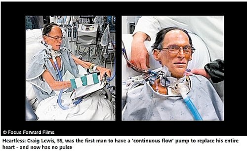 ����˹�������g(sh��)