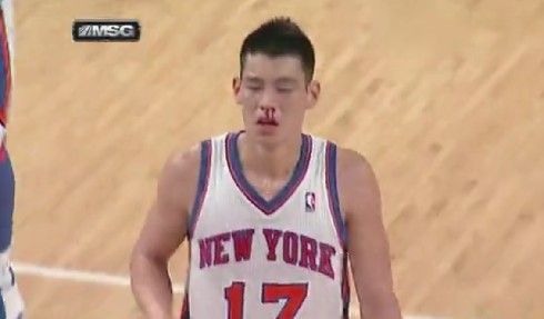 �����r�g2012��3��1�գ�NBA��Ҏ(gu��)ِ���˹����Tʿ����ِ�M(j��n)�е���һ��(ji��)߀��2�ֶ�犣��֕�����һ�λ�픠���r�����o��Ŀ�˹��������ǿף��D�r��Ѫֱ����ֻ������Ϣ���ɴ��S˹�ǈ��M����