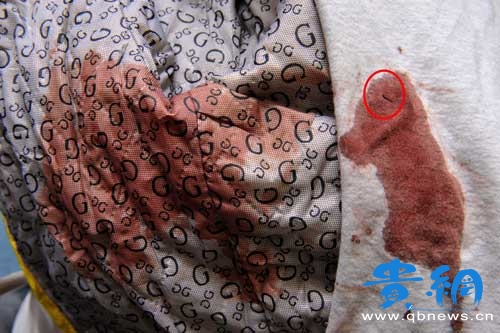 ��ײһ�²���Ǹ �����W��������һ�W��(�M�D)