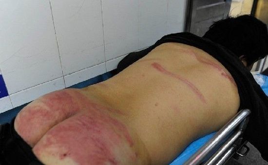 ����С؜���ǹܱ��� ���˷Q�䱻���ψ̷�܇(�D)