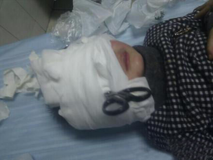 3歲男童將剪刀插入顱內 連夜輾轉百公里就醫(圖)