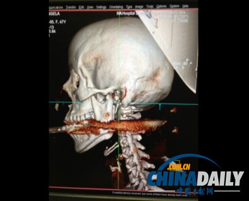 һ������Ů�ӱ��~���`������У����x����H1���ף����E����߀��