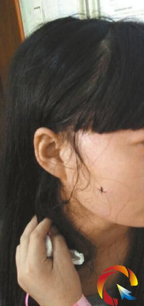 高三女生拒陪室友聊天被劃5刀 其中1刀在臉上